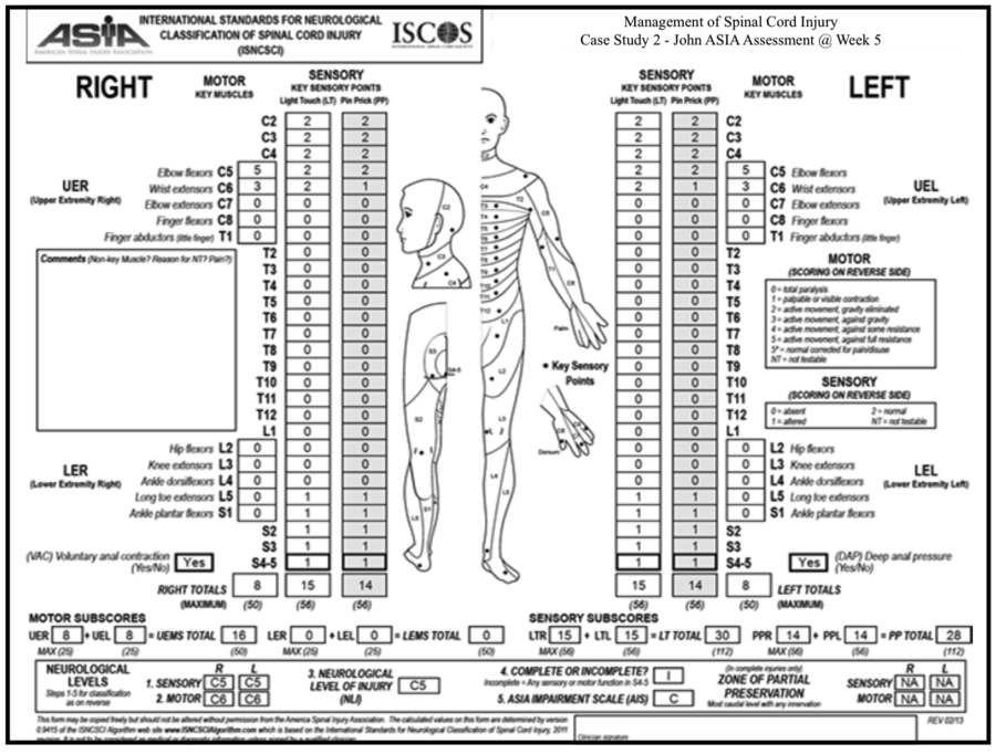 Management Of Spinal Cord Injuries - Case Study Part 2 - Physiopedia